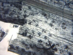 2018-05 What Are Mycorrhizae